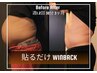 【夏に向けてダイエット】貼るだけWINBACK  30分 3500円