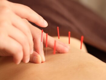 タオ 京都烏丸(TaO)/美容鍼の効果