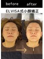 エレヴィザ トウキョウ 恵比寿院(ELVISA TOKYO) 姿勢改善整体/骨盤矯正/恵比寿/東京/渋谷/広尾/小顔矯正