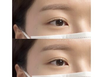 ソエカ ベリンダ(SOECA belinda)/大人気のセットコース