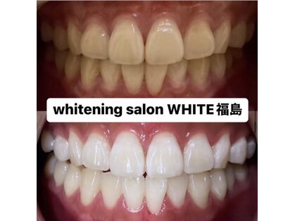 ホワイトニングサロン ホワイト(WHITE)の写真