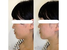 整え屋 レッド(RED)/阿波座/本町/小顔矯正/美容整体