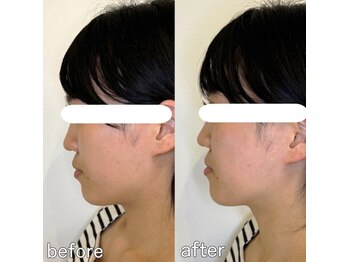 整え屋 レッド(RED)/阿波座/本町/小顔矯正/美容整体