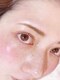 ラフィーユ 豊崎本店(La fille)の写真/目元シワ・たるみ・まつ毛の減少改善◎マツエク、カールと一緒に目元ケアも♪目元の悩みに全てアプローチ◎