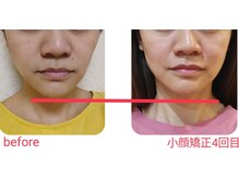 エム(M)/整体　小顔矯正　顔脱毛
