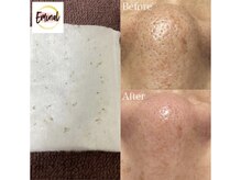 エミナル(EMINAL)の雰囲気（◇毛穴洗浄＋顔脱毛◇ 自己処理から解放！ツルスベ肌GET♪ ）