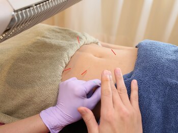 段上はり灸整骨院の写真/自律神経を整えると…妊活にも◎頭痛/めまい/眼精疲労/動悸/疲れ解消/睡眠改善