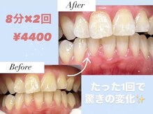 ハモットホワイト(Hamotto White)