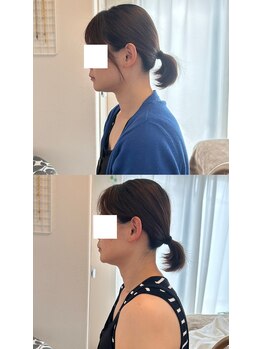 グリッタープラス(glitter plus)/首の角度と肩の位置が変わる!