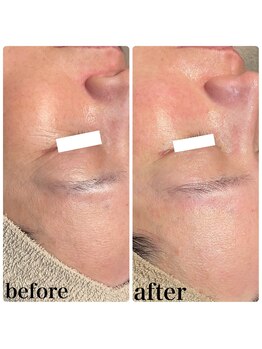 ディオーネ 春日井勝川店(Dione)/マーメイドセルトリートメント