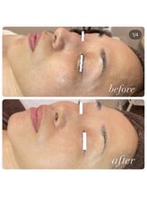 ラディエンス 多治見店/リアボーテマーメイドセルエステ