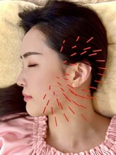 グラン治療院 東京/食いしばり