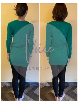 フェルナ(FERNA)/before/after &nbsp;見た目が違う