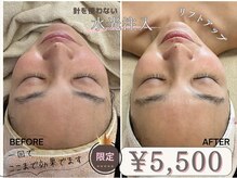 マヴィ 高槻店(MavY.)/フェイスライン別人級