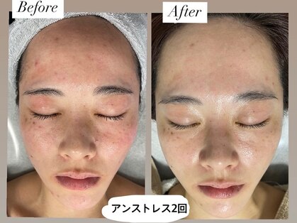 シェイミー(shaime)の写真