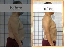 ダイエット工房 菊/【1年間】マイナス20kg達成