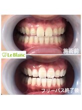 ルブラン 奈良店(Le Blanc)/最低保証回数でキレイに！！