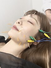 ハリナチュレ 南流山店/持続効果の高い美容鍼を