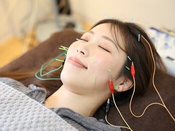 ハリベアー(HariBear)/お顔がすっきりする美容鍼