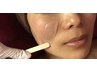 初めてのマツヤニパック(パッチテスト済みの方)   