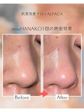 アルパカ(ALPACA)/missHANAKO