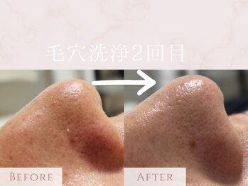 ル シャの写真/《メンズ専門 隠れ家サロン》今だけ【新規限定】フェイシャル毛穴洗浄or頭皮洗浄⇒6,000円