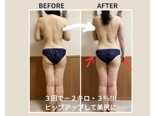 ヨサパーク ミラー(YOSAPARK Mirror)の雰囲気（3回で－2キロ・3％!!お尻＆太もものセル脂肪が燃焼、美脚へ◎）