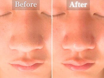 ボーンオム(Born Homme)