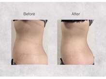 ミセル 尾道店(MYTHEL)/セルバーン　before after