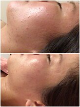 ロゼブランシュ(Rose Blanche)/