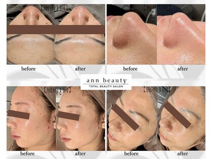 アン ビューティー(ann beauty)の写真