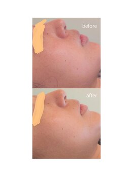 トトノウ(TOTONOU)/Before After