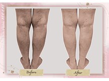 ヌーン(noon)/冷え改善・代謝アップ・血行促進