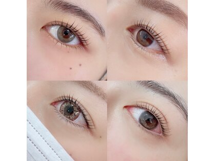 オルト(ORT)の写真