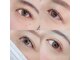 オルト(ORT)の写真