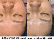 ベリンダ(BELINDA)/セルマンピーリング