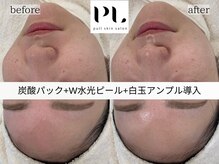 プル スキンサロン(pull skin salon)/