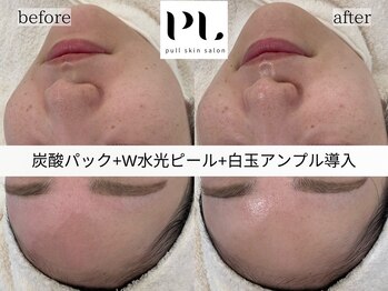 プル スキンサロン(pull skin salon)/