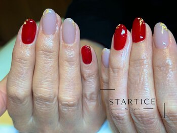 スターチス(STARTICE)/定額シンプルコース