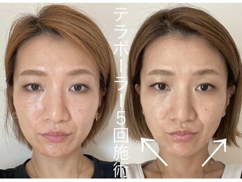 エクレクティック(ECLECTIC)/コツコツたるみ改善/宇都宮小顔