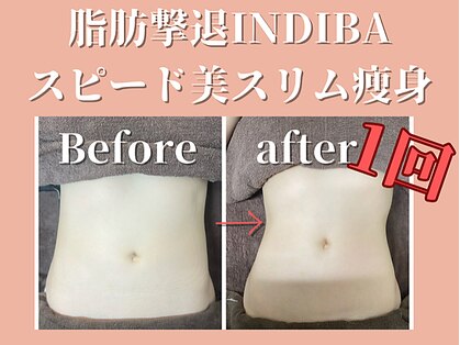 エステサロン ヴリエ 立川店の写真