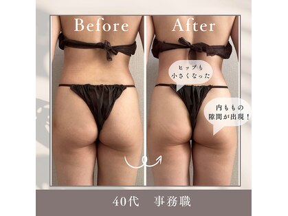 タノソイネ(tanosoine)の写真