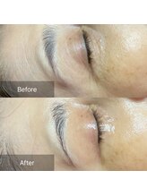 ヒール(heal)/50代　目元のお悩み解決