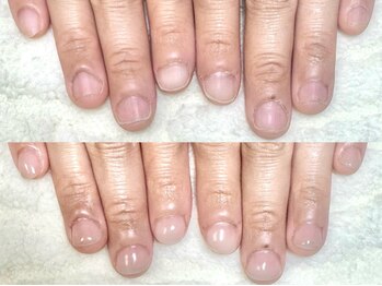 グラシナ 鳥丸店/(深爪/長さだし/フィルイン/)