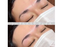 フェイスの雰囲気(開業29年目の信頼と実績/全員が厳しい研修をクリアしたスタッフ)