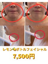 ファム 蓮台寺店(FAM)&nbsp;レモン ボトル