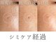 レイミー(reimee)の写真