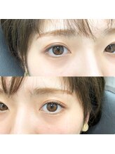 アーリ 高槻店(ALI)/ビフォーアフター写真