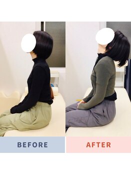 ナオル整体 三鷹院(NAORU整体)/20代女性施術事例【頚部後屈】
