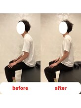 ナオル整体 福岡香椎院(NAORU整体)/30代男性施術事例【猫背】